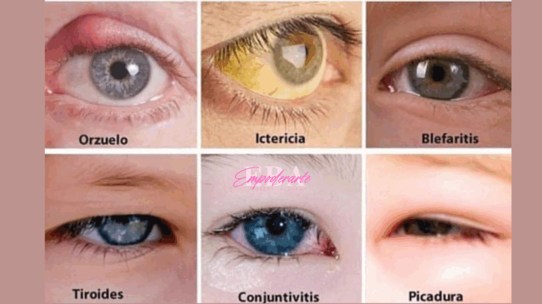 Enfermedades e Infecciones